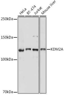 Western Blot: KDM2A/FBXL11 AntibodyAzide and BSA Free [NBP3-15577]