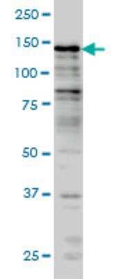 Western Blot: KDM2B Antibody (5G1) [H00084678-M09]