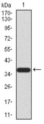 Western Blot: KDM2B Antibody (6F6G11)BSA Free [NBP2-52467]