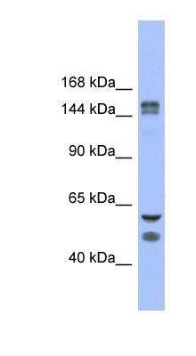 Western Blot: KDM2B Antibody [NBP1-80379]