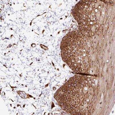 Immunohistochemistry-Paraffin: KDM4E Antibody [NBP2-49124]