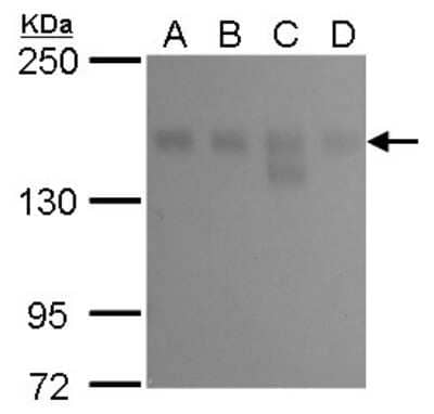 Western Blot: KDM6A Antibody (1612) [NBP2-43665]