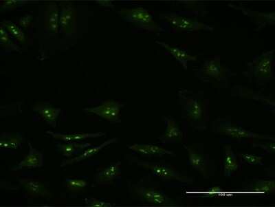 Immunocytochemistry/ Immunofluorescence: KDM6A Antibody (4E7) [H00007403-M05]