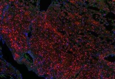 Immunohistochemistry-Paraffin: KDM6A Antibody [NBP1-80628]