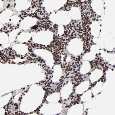 Immunohistochemistry-Paraffin: KDM6A Antibody [NBP1-80628]