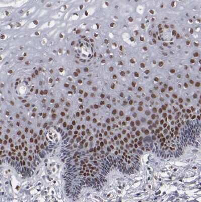 Immunohistochemistry-Paraffin: KDM6A Antibody [NBP1-80628]