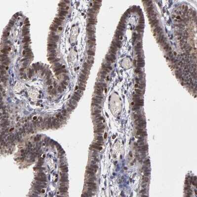 Immunohistochemistry-Paraffin: KDM6A Antibody [NBP1-80628]