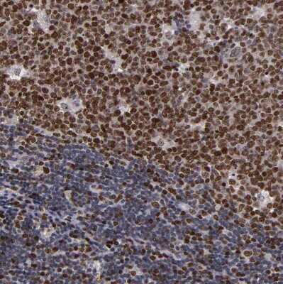 Immunohistochemistry-Paraffin: KDM6A Antibody [NBP1-80628]