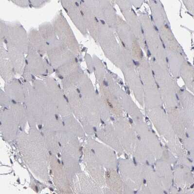 Immunohistochemistry-Paraffin: KDM6A Antibody [NBP1-80628]