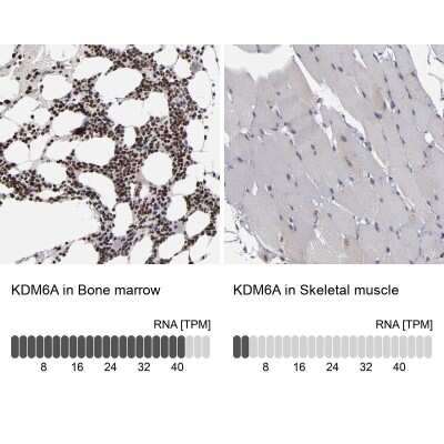 Immunohistochemistry-Paraffin: KDM6A Antibody [NBP1-80628]