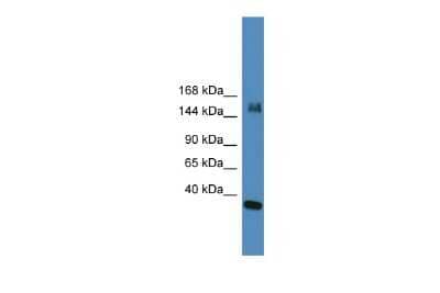 Western Blot: KDM6A Antibody [NBP2-87671]