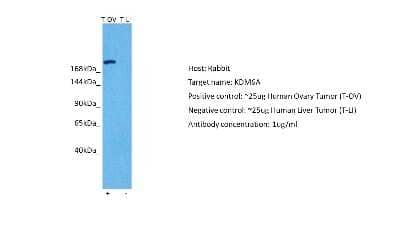 Western Blot: KDM6A Antibody [NBP2-87672]