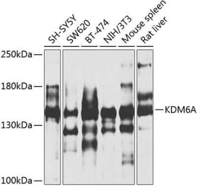 Western Blot: KDM6A AntibodyAzide and BSA Free [NBP3-05103]