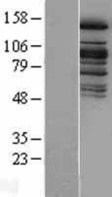 Western Blot: KDM6A Overexpression Lysate [NBL1-17682]