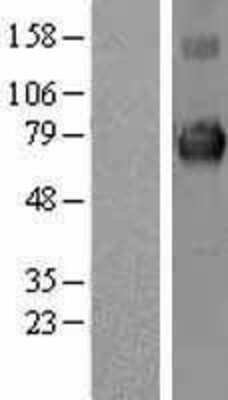 Western Blot: Keap1 Overexpression Lysate [NBL1-12225]