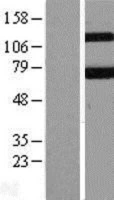 Western Blot: Keap1 Overexpression Lysate [NBL1-12226]