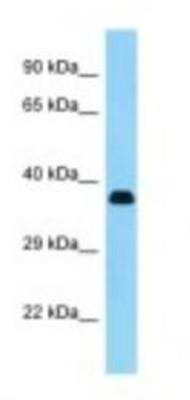 Western Blot: KERA Antibody [NBP1-98389]