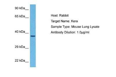 Western Blot: KERA Antibody [NBP1-98389]