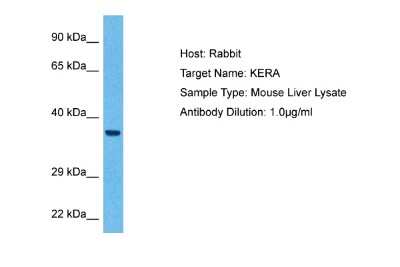 Western Blot: KERA Antibody [NBP1-98389]