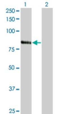 Western Blot: KF1 Antibody (3E7) [H00007844-M01]