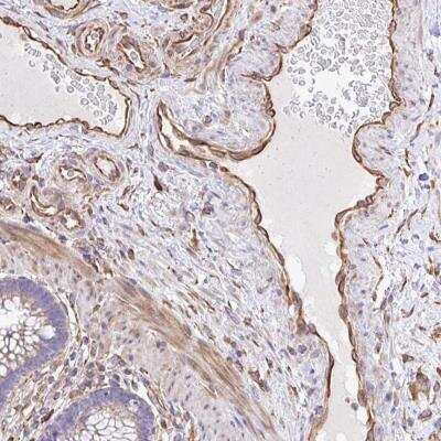 Immunohistochemistry-Paraffin: KF1 Antibody [NBP2-31700]