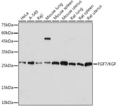 Western Blot: KGF/FGF-7 Antibody (4L2O8) [NBP3-16623]