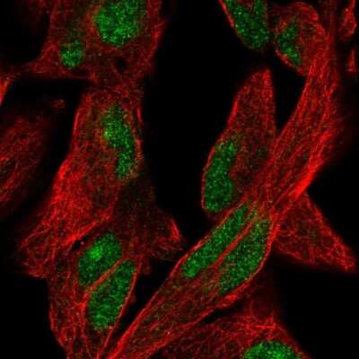 Immunocytochemistry/ Immunofluorescence: KGF/FGF-7 Antibody [NBP1-91898]