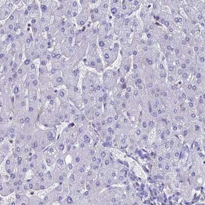 Immunohistochemistry-Paraffin: KGF/FGF-7 Antibody [NBP1-91898]