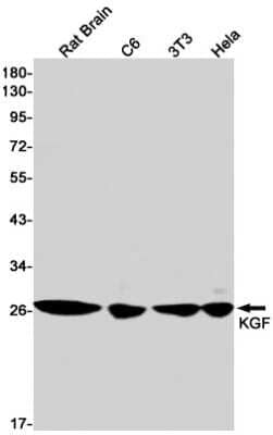 Western Blot: KGF/FGF-7 Antibody (S07-5C6) [NBP3-14948]