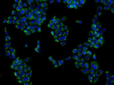 Immunocytochemistry/ Immunofluorescence: KHDC1 Antibody [NBP3-06228]