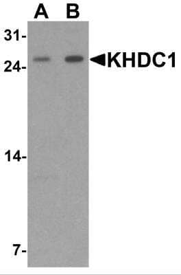 Western Blot: KHDC1 AntibodyBSA Free [NBP2-81729]