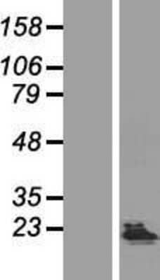 Western Blot: KHDC1 Overexpression Lysate [NBL1-12229]