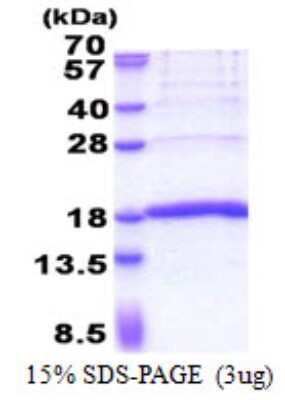 SDS-PAGE: Recombinant Human KHDC1L His Protein [NBP2-23167]