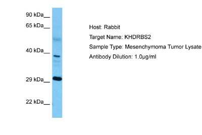 Western Blot: KHDRBS2 Antibody [NBP2-87679]