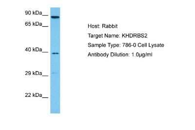 Western Blot: KHDRBS2 Antibody [NBP2-87680]