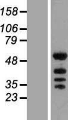 Western Blot: KHDRBS2 Overexpression Lysate [NBL1-12230]