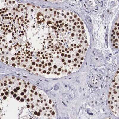 Immunohistochemistry-Paraffin: KHDRBS3 Antibody [NBP1-84773]