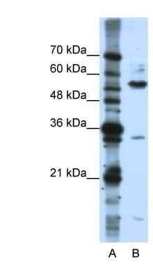 Western Blot: KHDRBS3 Antibody [NBP1-57104]