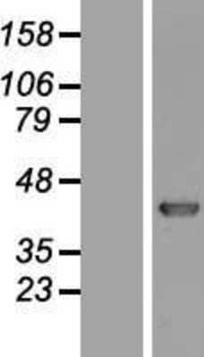 Western Blot: KHDRBS3 Overexpression Lysate [NBL1-12231]