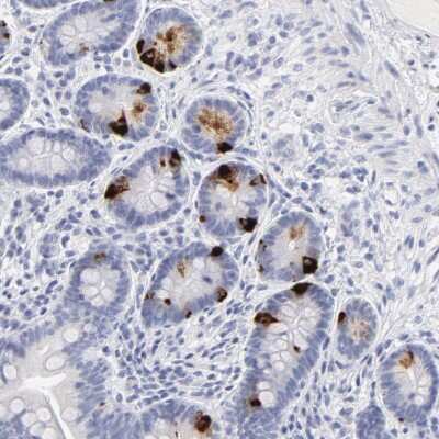 Immunohistochemistry-Paraffin: KHNYN Antibody [NBP1-81514]