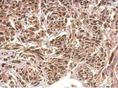 Immunohistochemistry-Paraffin: KHNYN Antibody [NBP2-17041]