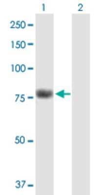 Western Blot: KHNYN Antibody [H00023351-B01P]