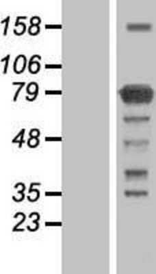 Western Blot: KHNYN Overexpression Lysate [NBL1-12242]