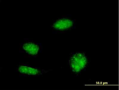 Immunocytochemistry/ Immunofluorescence: KHSRP Antibody (2F3) [H00008570-M03]