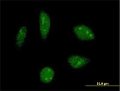 Immunocytochemistry/ Immunofluorescence: KHSRP Antibody (4C10) [H00008570-M01]