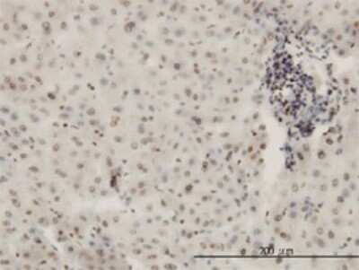 Immunohistochemistry-Paraffin: KHSRP Antibody (4C10) [H00008570-M01]
