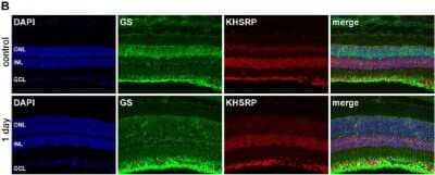 Immunohistochemistry: KHSRP Antibody [NBP1-18910]