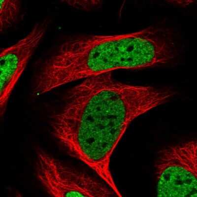 Immunocytochemistry/ Immunofluorescence: KHSRP Antibody [NBP1-84719]
