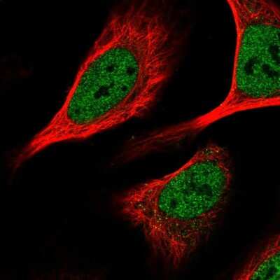 Immunocytochemistry/ Immunofluorescence: KHSRP Antibody [NBP2-56700]