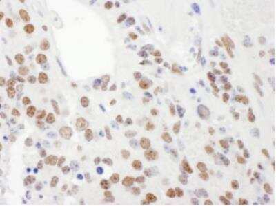 Immunohistochemistry-Paraffin: KHSRP Antibody [NBP1-18910]